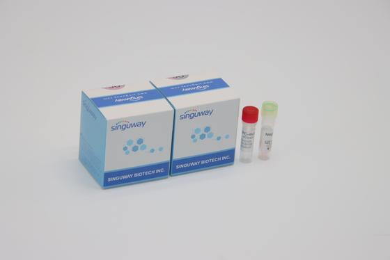 Equipo fluorescente cuantitativo IVD de la detección de la polimerización en cadena para toda la Corona Virus Mutations