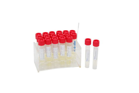 virus disponible 2mL que muestrea el tubo de ensayo de Kit Medical VTM con el palillo de la esponja de la garganta