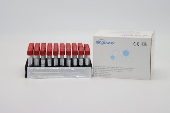 Equipo ISO13485 Singuway de la extracción de la DNA de Kit Viral el reactivo de la extracción del lanzamiento de la muestra
