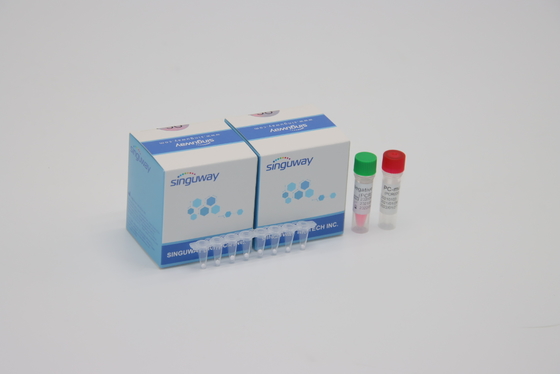 CE fluorescente cuantitativo del tiempo real del equipo POCT de la detección de la polimerización en cadena del virus del VIH