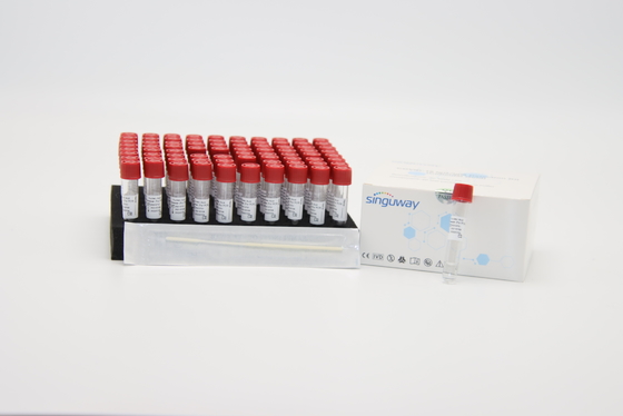 Materiales consumibles del laboratorio pequeño equipo de la purificación de la DNA de la polimerización en cadena de Kit Pharynx Swab de la extracción del ARN