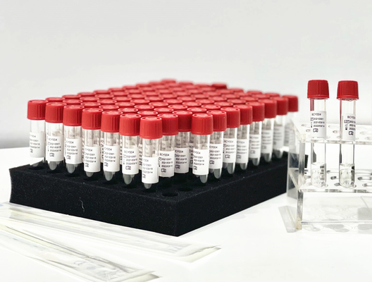 Una extracción Kit From Patient Pharynx Swab de la polimerización en cadena el reactivo del lanzamiento de la muestra del paso