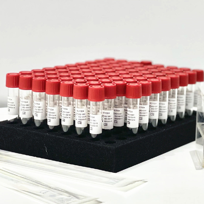 Tubo nasal del equipo 0.5mL/de la extracción el reactivo del lanzamiento de la muestra de la esponja de la faringe sin el proceso previo