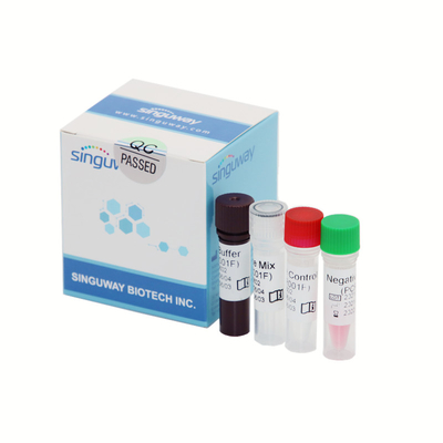Equipo en tiempo real de diagnóstico cuantitativo 40uL de la polimerización en cadena del VIH para el virus de inmunodeficiencia humana